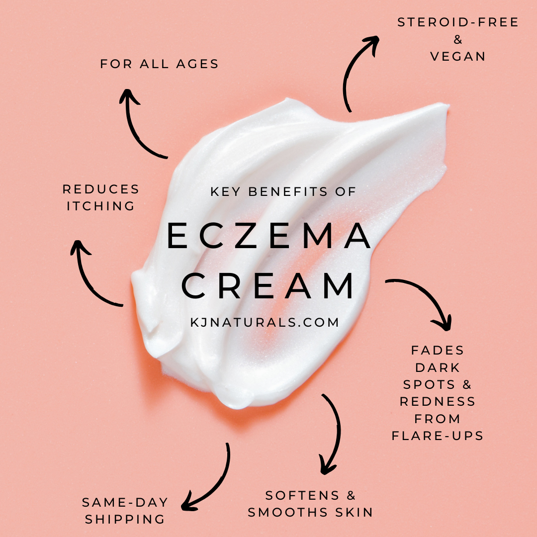 Natural Eczema Cream- NO steroids! For daily all-over use or problem areas.